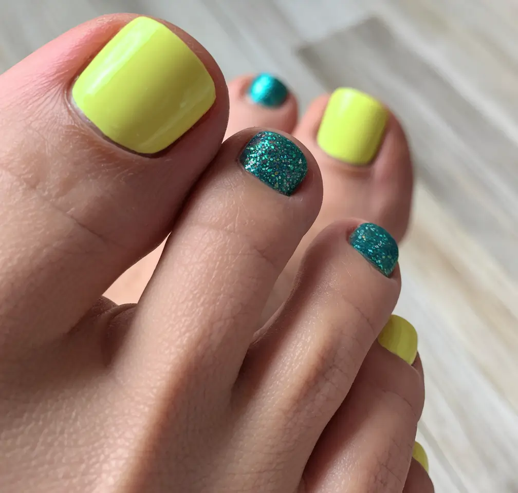 june toe nails ideas 2025 Lemon & Teal Party Mix