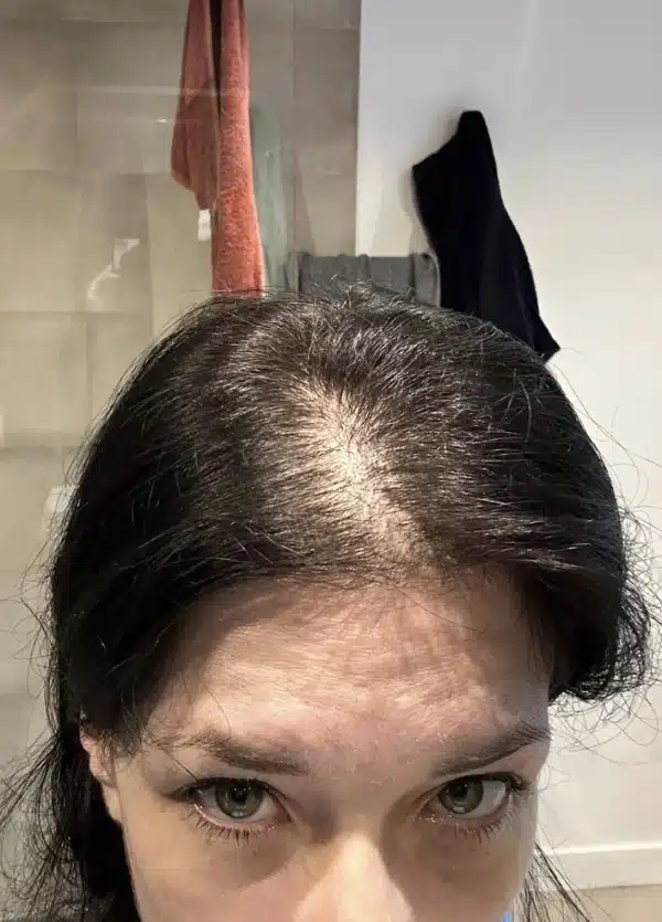 Shoulder Visual Idea — Winter Hairstyles for Thin Hair